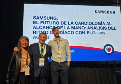 Samsung Galaxy Watch: cómo su precisión ayuda a cuidar el corazón